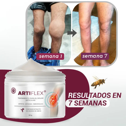 crema para las articulaciones artiflex
