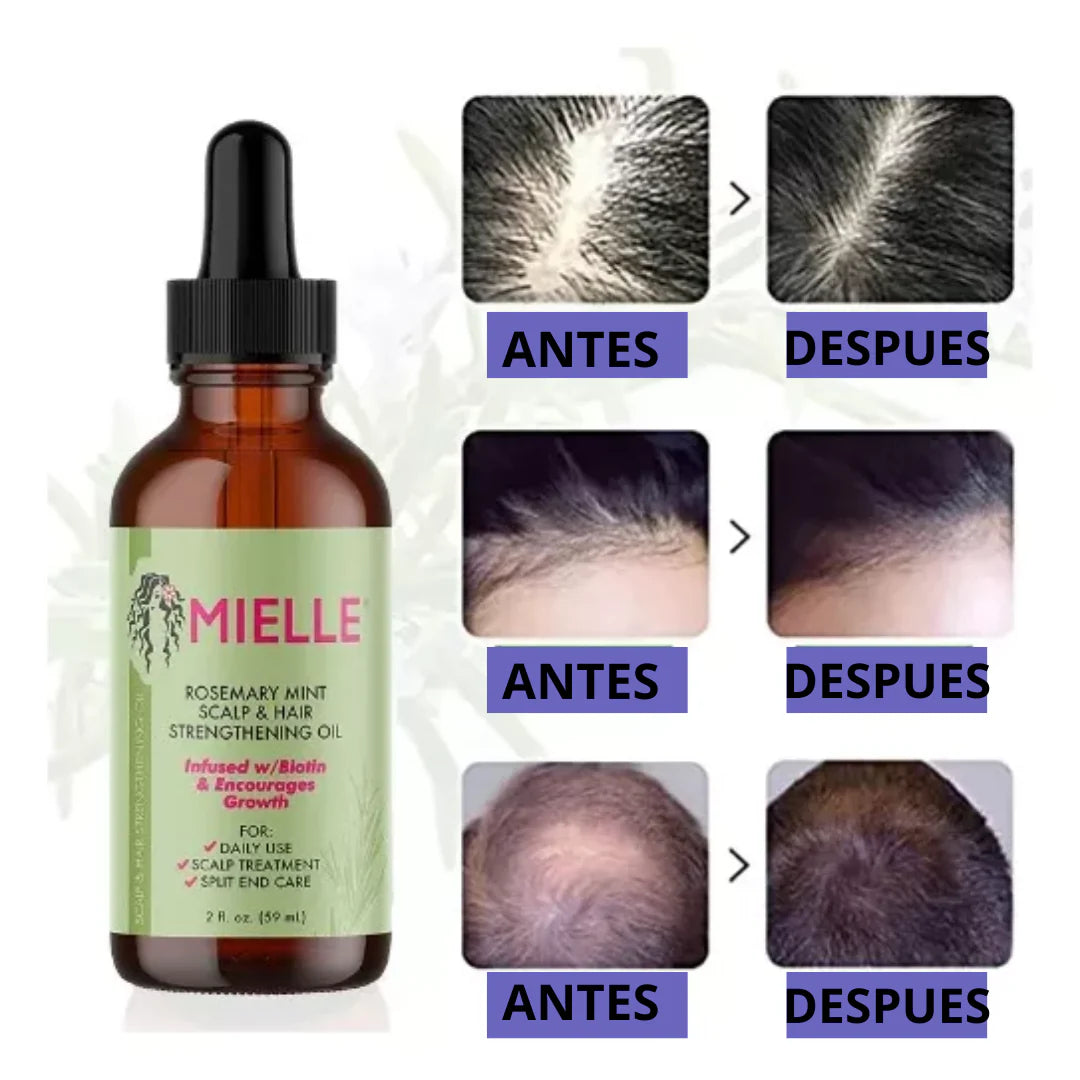Aceite de romero crecimiento Rosemary Mint Scalp & Hair Strengthening Oil de Mielle